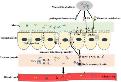 The role and mechanisms of gut microbiota in diabetic nephropathy, diabetic retinopathy and cardiovascular diseases